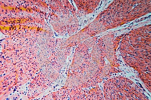 Cell microscopic- pyloric division stomach