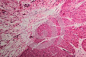 Cell microscopic- pyloric division stomach