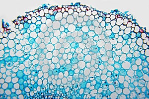 Cell microscopic- Vicia Faba photo