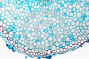Cell microscopic- Vicia Faba photo