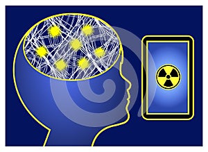 Cell phone radiation triggers epilepsy