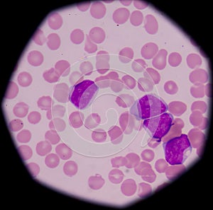 Cells in bone marrow
