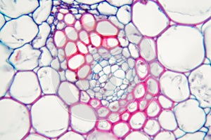 Cells of a Buttercup steam Caltha palustris.