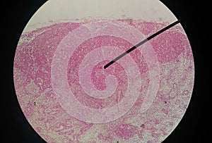 Cells of human find with microscope.