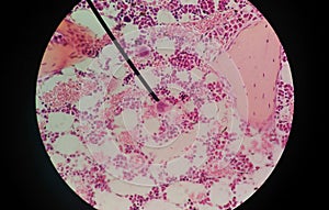 Cells of human find with microscope.