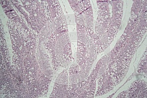 Cells of a human large intestine under the microscope photo