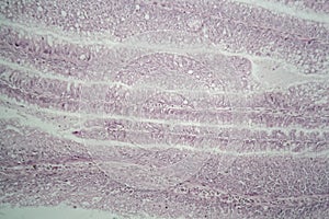 Cells of a human large intestine under the microscope photo