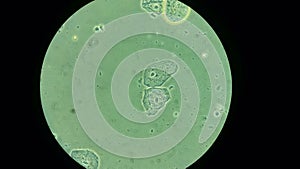 Cells on a Microscope photo