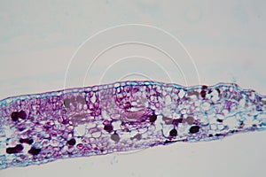 Cells of a plant leaf with damaged epidermis and chloroplasts under a microscope