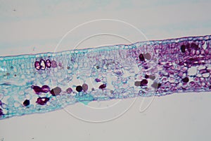 Cells of a plant leaf with damaged epidermis and chloroplasts under a microscope