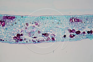 Cells of a plant leaf with damaged epidermis and chloroplasts under a microscope