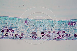 Cells of a plant leaf with damaged epidermis and chloroplasts under a microscope