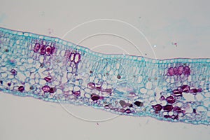 Cells of a plant leaf with damaged epidermis and chloroplasts under a microscope