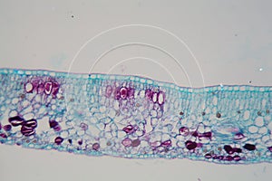 Cells of a plant leaf with damaged epidermis and chloroplasts under a microscope