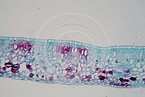 Cells of a plant leaf with damaged epidermis and chloroplasts under a microscope photo