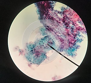 Cells in reproductive female cytology and histology concept