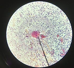 Cells in reproductive female cytology and histology concept