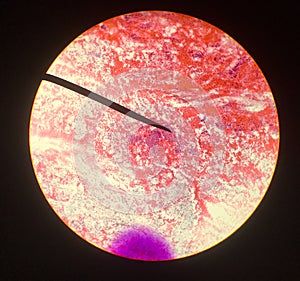 Células en reproductivo una mujer a histología 