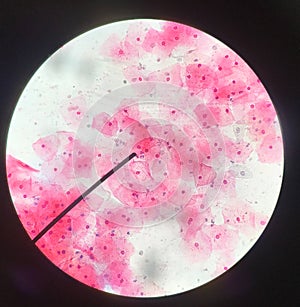 Cells in reproductive female cytology and histology concept photo