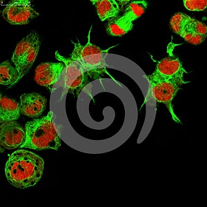 Cells under microscope photo