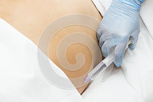 Cellulite mesotherapy