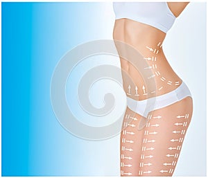 The cellulite removal plan. White markings on young woman body