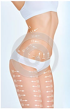 The cellulite removal plan. White markings on young woman body