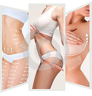 The cellulite removal plan. White markings on young woman body