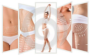 The cellulite removal plan. White markings on young woman body photo