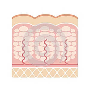 Cellulite`s skin vector illustration