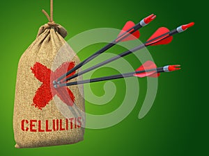 Cellulitis - Arrows Hit in Red Target. photo