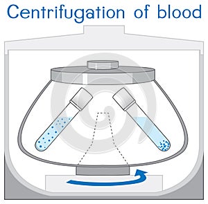 Centrifugation of blood machine