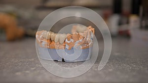 Ceramic crown of a tooth based on a plaster model of teeth, the work of a dental technician, tools for dental prosthetics.
