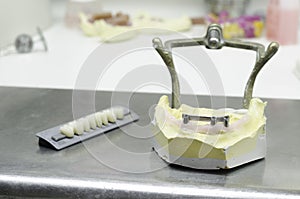 Ceramic crowns in dental laboratory, implants.