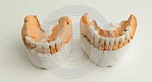 Ceramic dental crown