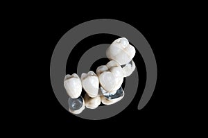 Ceramic dental crowns