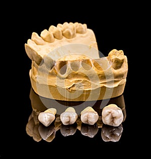 Ceramic dental implants