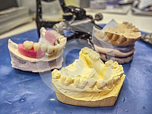 Ceramic dental implants on gypsum layout