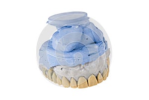 Ceramic dentures