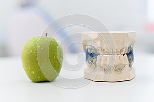 Ceramic jaws with a clasp lie with an apple on the table