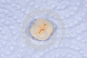 Ceramic-metal crown of a human tooth molar. Macro closeup. Dental laboratory, manufacture of tooth rub