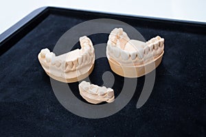 Ceramic teeth on a plaster model on a black background