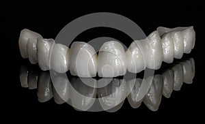 Ceramic zirconium. Teeth. Dental technician. photo