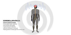 Ataxia cerebellar disorder photo