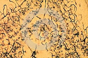 Cerebellar cortex. Granular layer