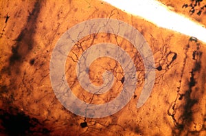 Cerebellar cortex. Stellate cells