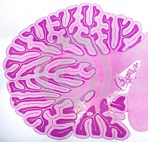 Cerebellum. Sagittal section