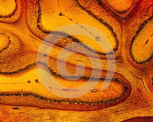 Cerebellum. Silver stain