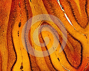 Cerebellum. Silver stain