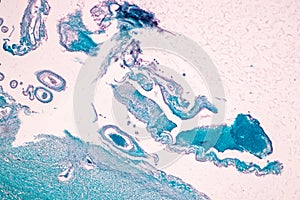 Cerebellum, Thalamus, Medulla oblongata, Spinal cord and Motor Neuron human under the microscope. photo